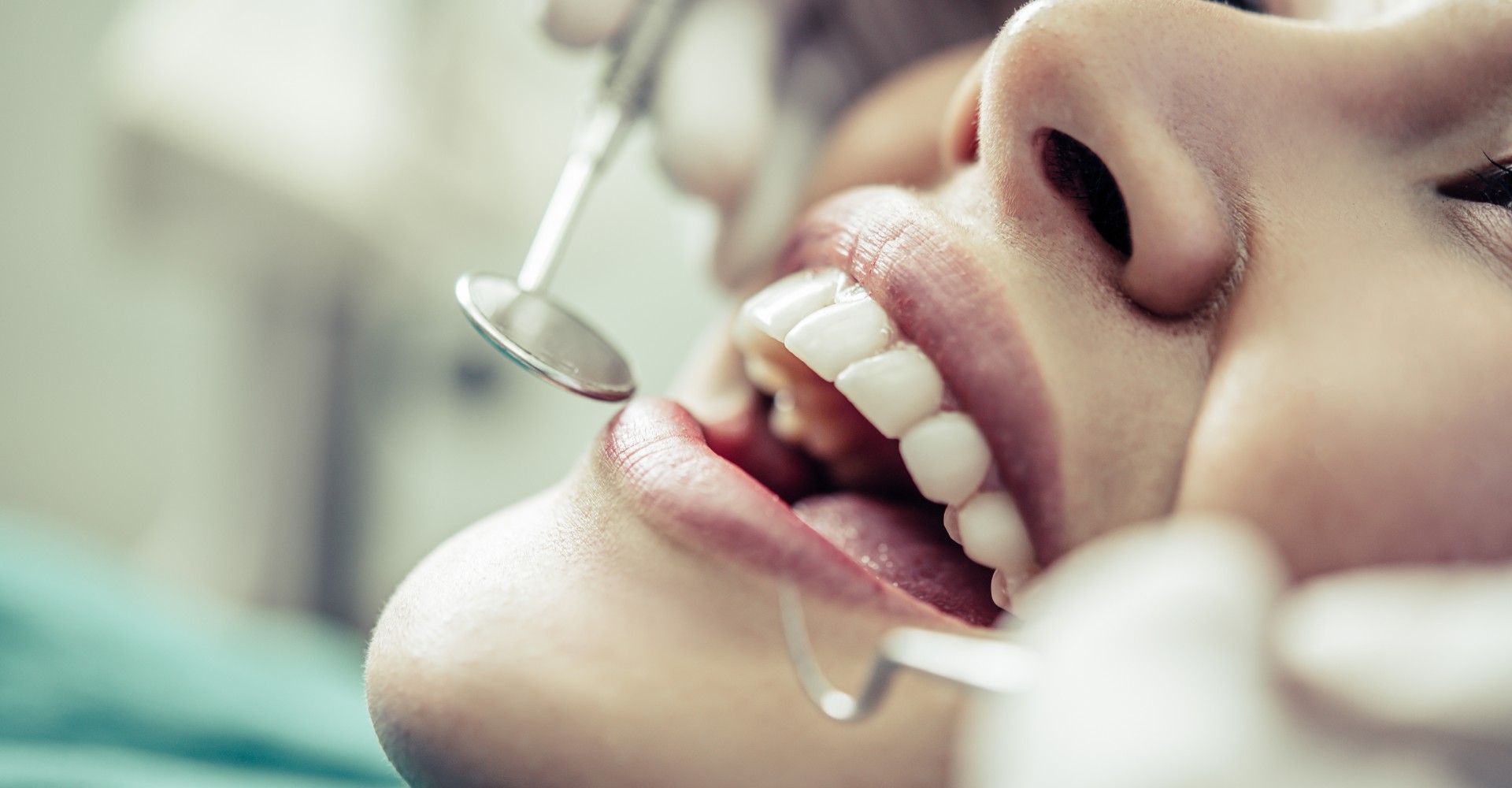 Do You Need to Prepare before Going to the Dentist?